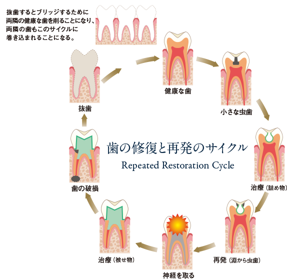 Repeated Restoration Cycle