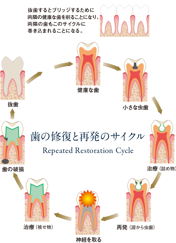 Repeated Restoration Cycle